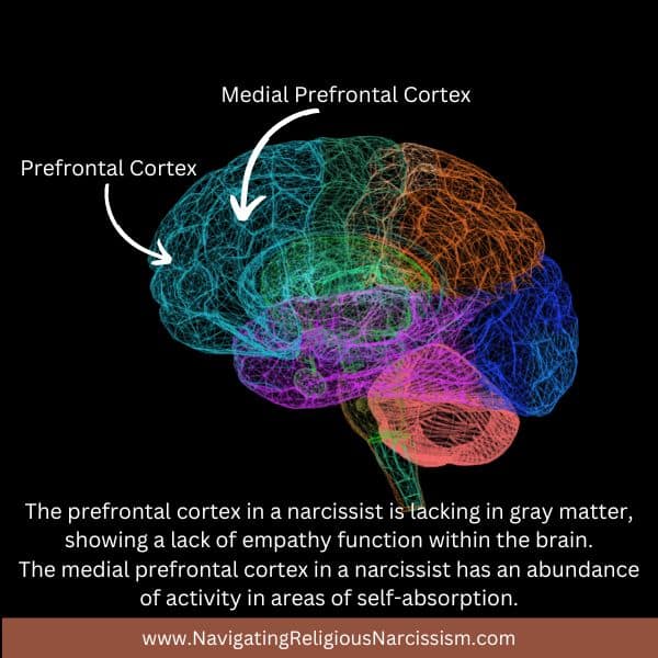 A graphic of a brain showing the prefrontal cortex and medial prefrontal cortex and how they are affected by narcissism. This graphic is part of the article, "How do Narcissists Become Narcissists."